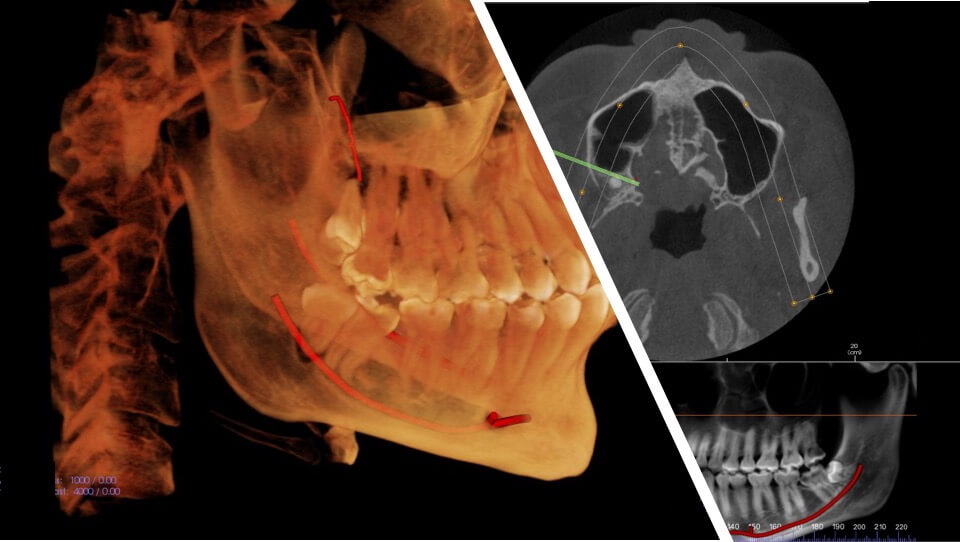 oral-and-maxillofacial-radiologist